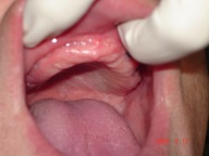 TIJUANA DENTIST