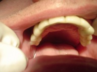 TIJUANA DENTIST