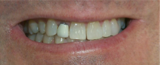 DENTISTAS EN TIJUANA