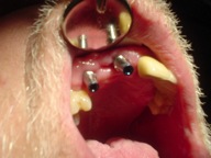 TIJUANA DENTIST
