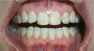 DENTISTAS EN TIJUANA